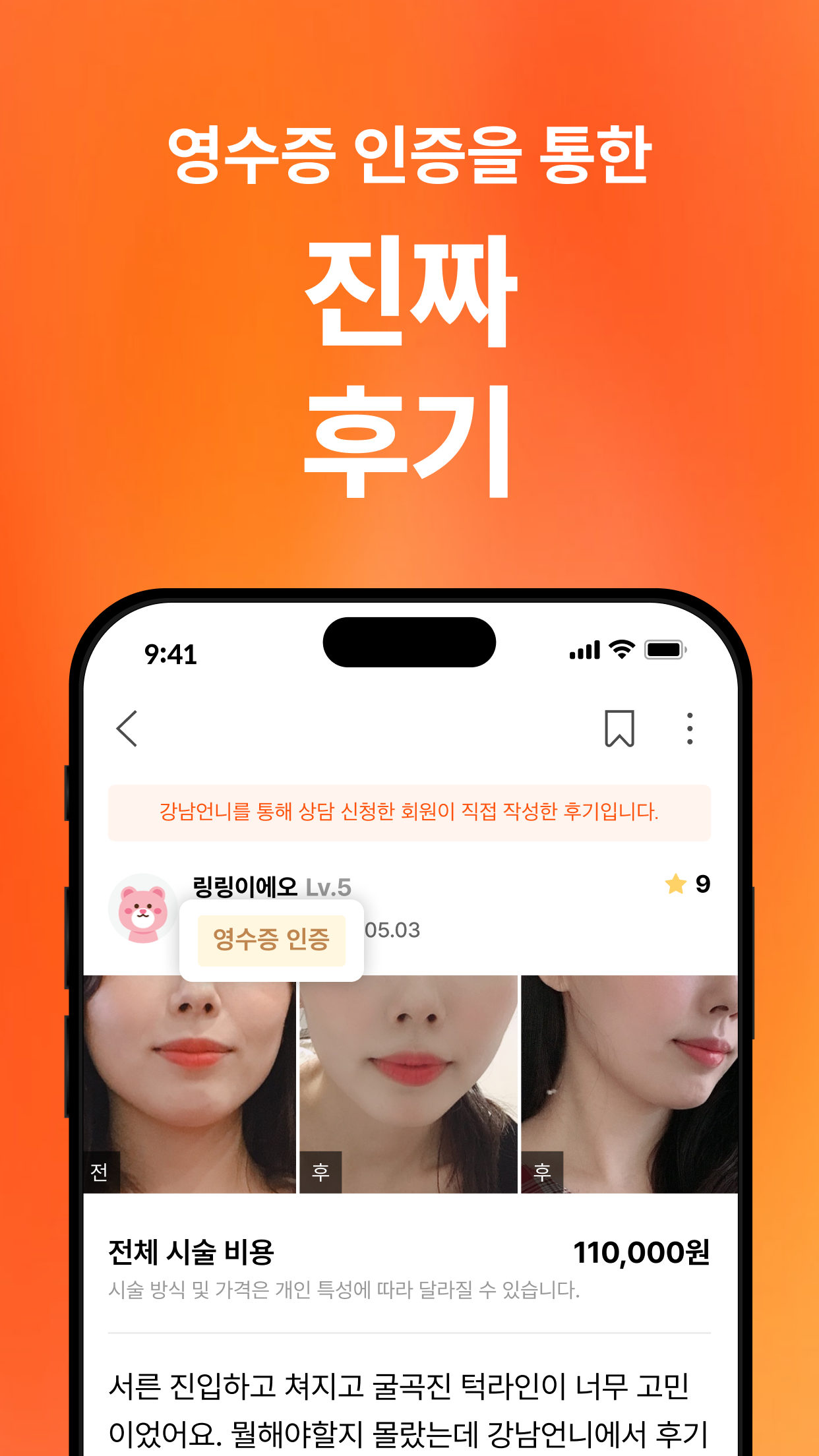 강남언니 어플 다운로드 스크린샷 3